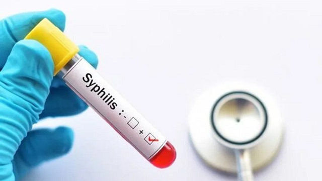 &ldquo;Crisis en el sistema de salud&rdquo;: especialistas advierten sobre el aumento de s&iacute;filis